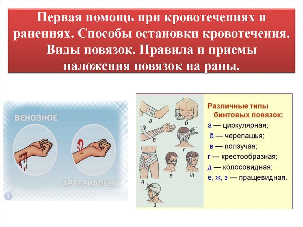 Оказание первой помощи при кровотечении.